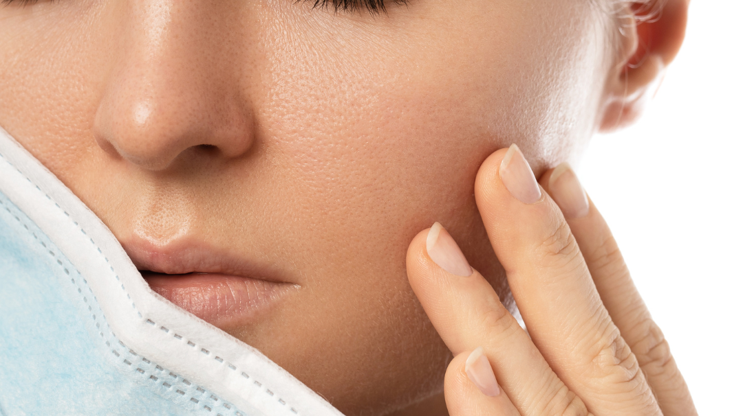 Mascné : éviter les imperfections liées au port du masque