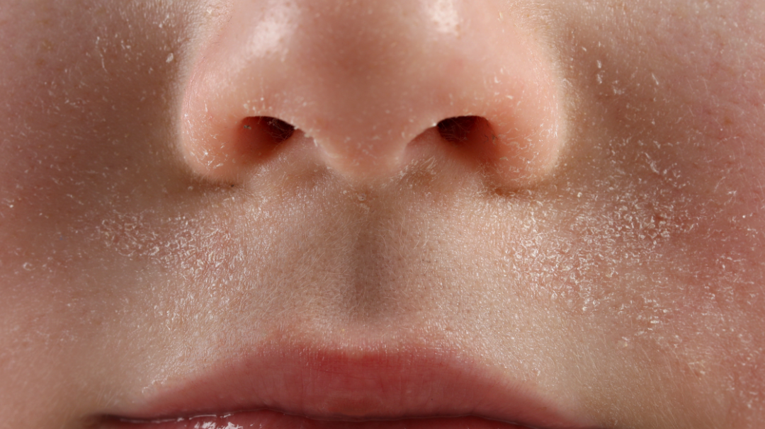 Quelle huile végétale pour ma peau sèche ?