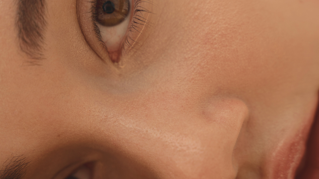 Pourquoi ai-je la peau très sèche ?