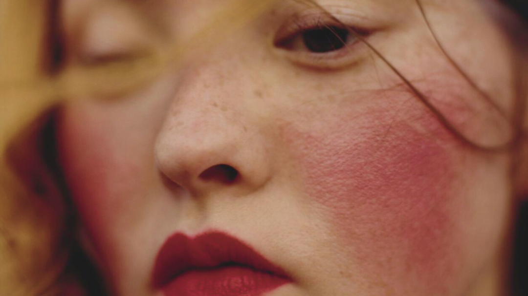 Comment traiter naturellement la couperose et la rosacée ?