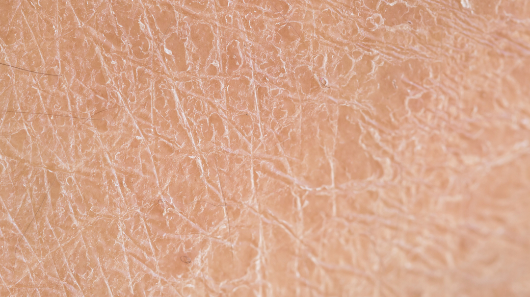 Les solutions naturelles pour prendre soin de ma peau déshydratée