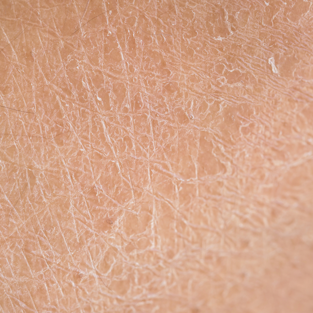 Les solutions naturelles pour prendre soin de ma peau déshydratée